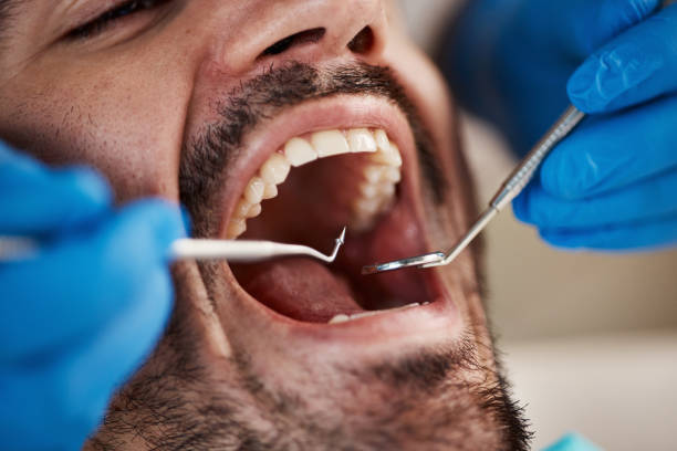 Oral Surgery in Baldwin, GA